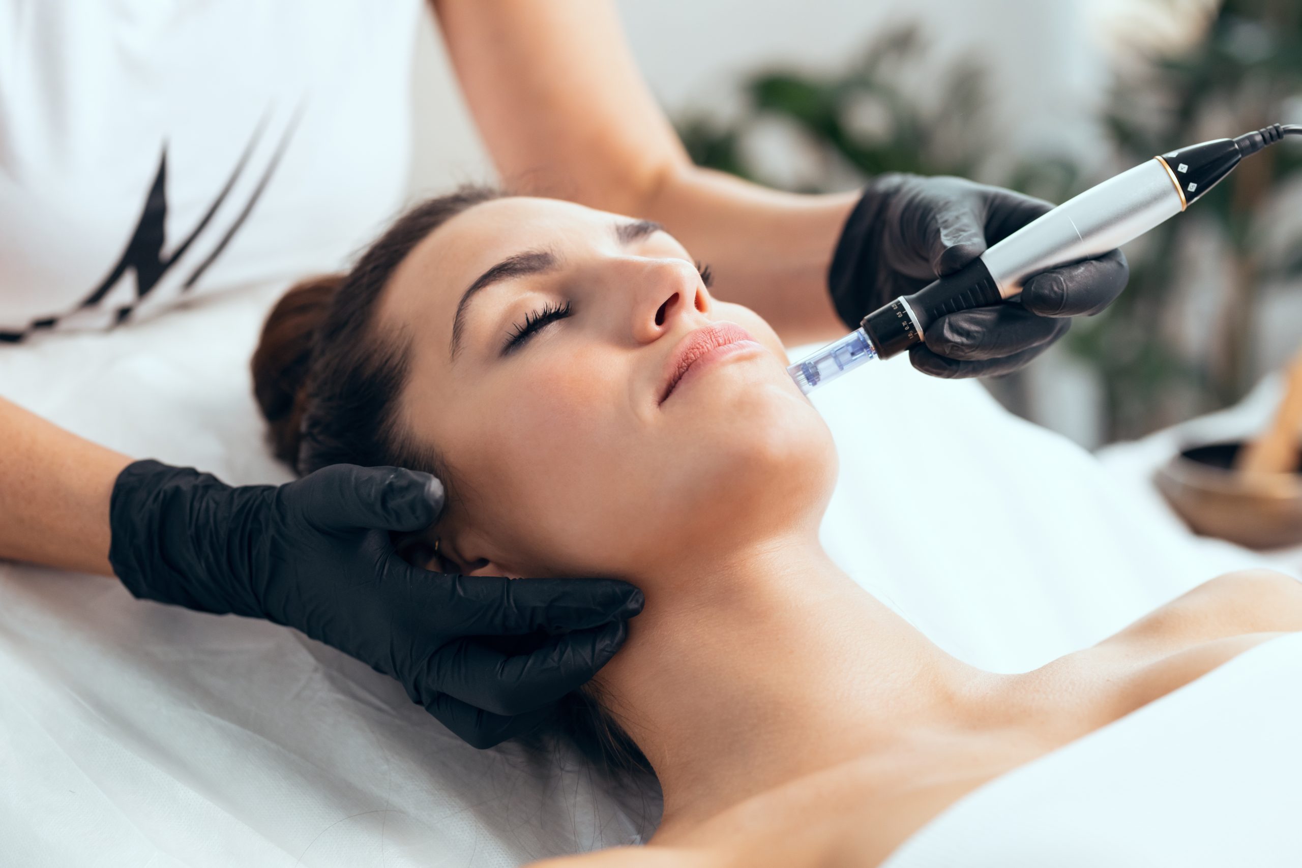 Choosing the Right Microneedling Professional