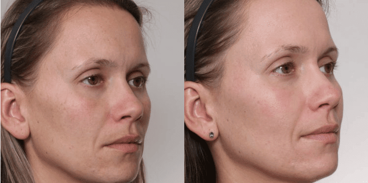 Achieving Your Skin Goals