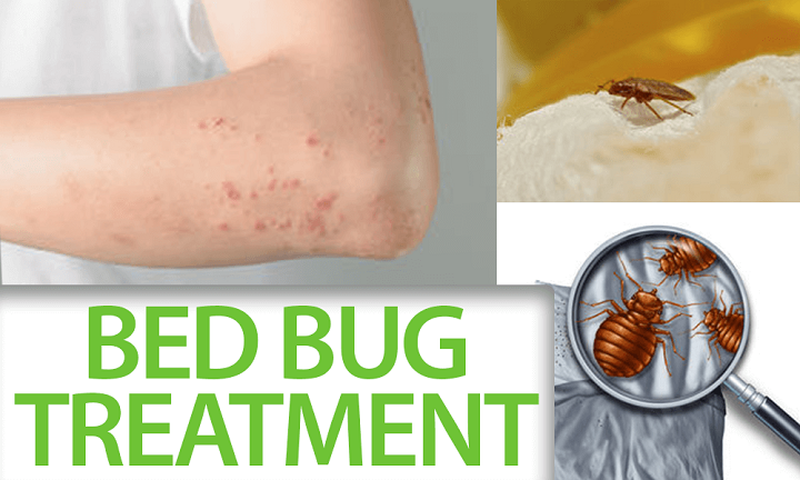 Signs and Symptoms of Bed Bugs