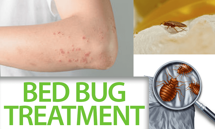 Bed Bug Removal Costs and Budgeting